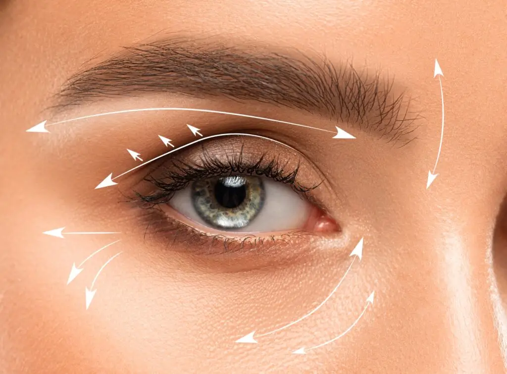 טיפול בשקיות מתחת לעיניים - מרכז לרפואת עור ואסתטיקה בהנהלת ד״ר אלה אגוזי