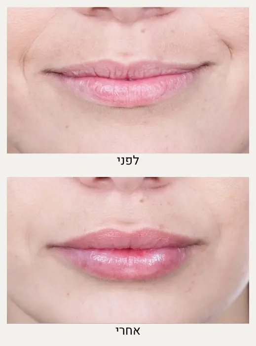 טיפול אסתטי לפנים באמצעות שיטת 8 הנקודות - ד״ר אלה אגוזי