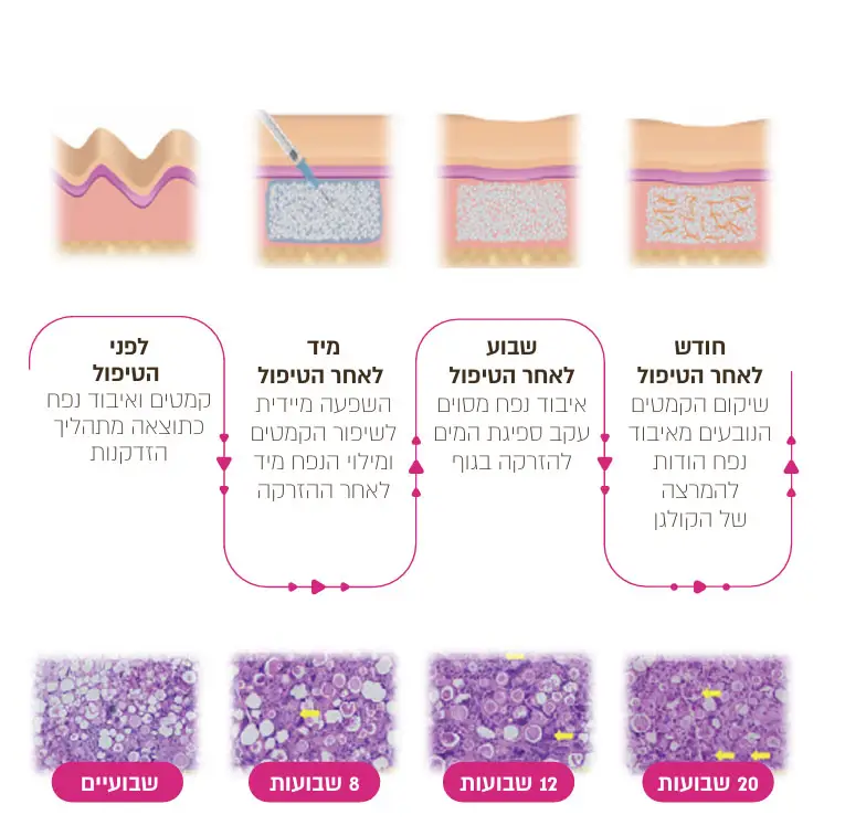 מנגנון טיפול ביוסטימולטור - ד"ר אלה אגוזי