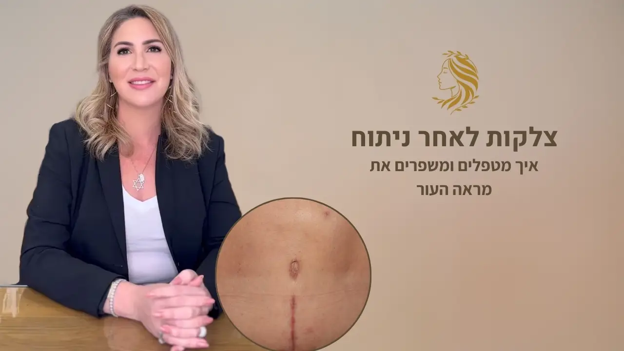 סרטון - טיפול בצלקות אחרי ניתוח, ד"ר אלה אגוזי, מומחית לרפואת עור ואסתטיקה