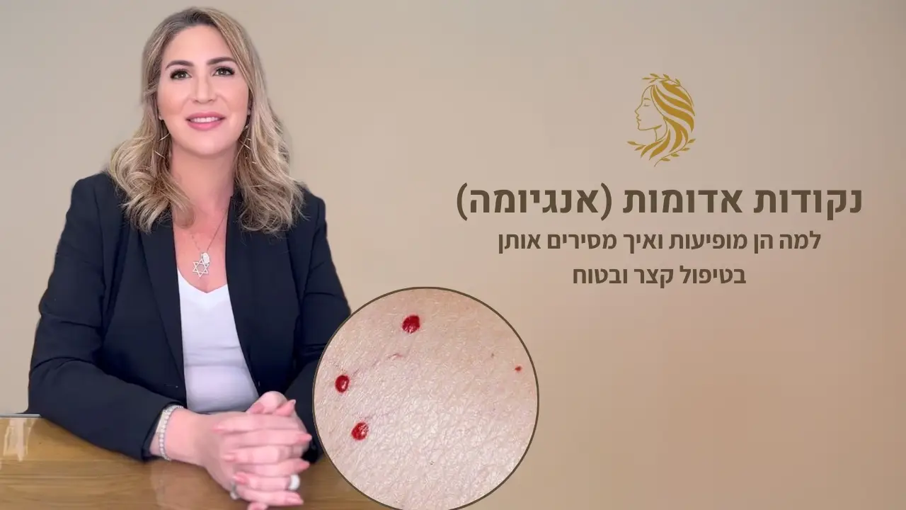 סרטון - הסרת נקודות אדומות, ד"ר אלה אגוזי, מומחית לרפואת עור ואסתטיקה