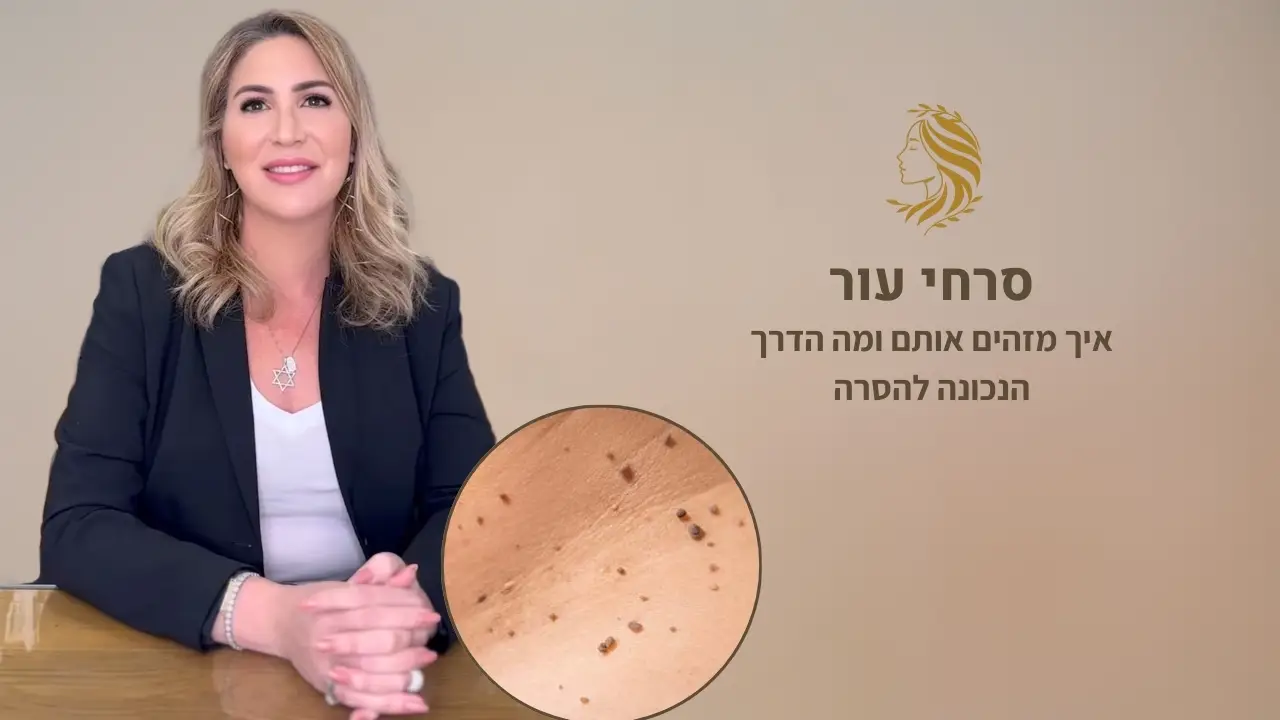 סרטון - הסרת סרחי עור, ד"ר אלה אגוזי, מומחית לרפואת עור ואסתטיקה