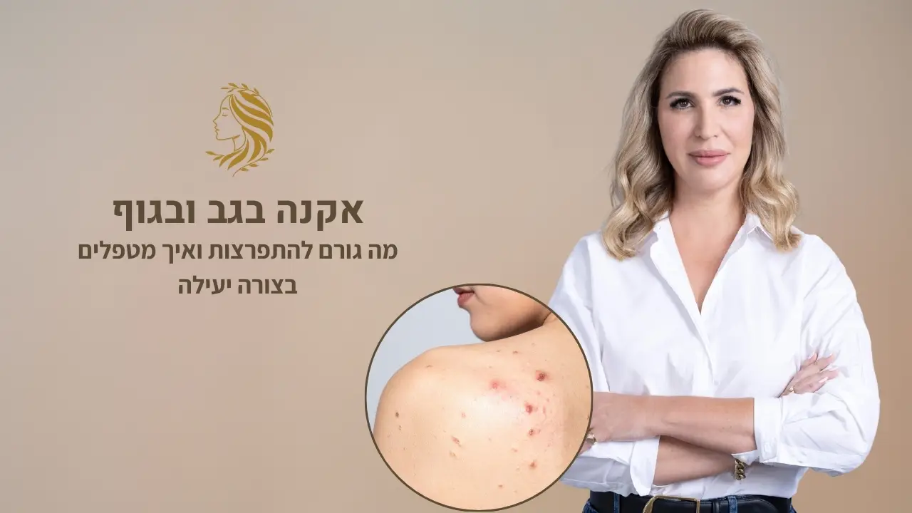 סרטון - טיפול באקנה בגוף, ד"ר אלה אגוזי, מומחית לרפואת עור ואסתטיקה