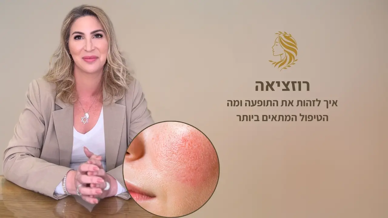סרטון - טיפול ברוזציאה, ד"ר אלה אגוזי, מומחית לרפואת עור ואסתטיקה