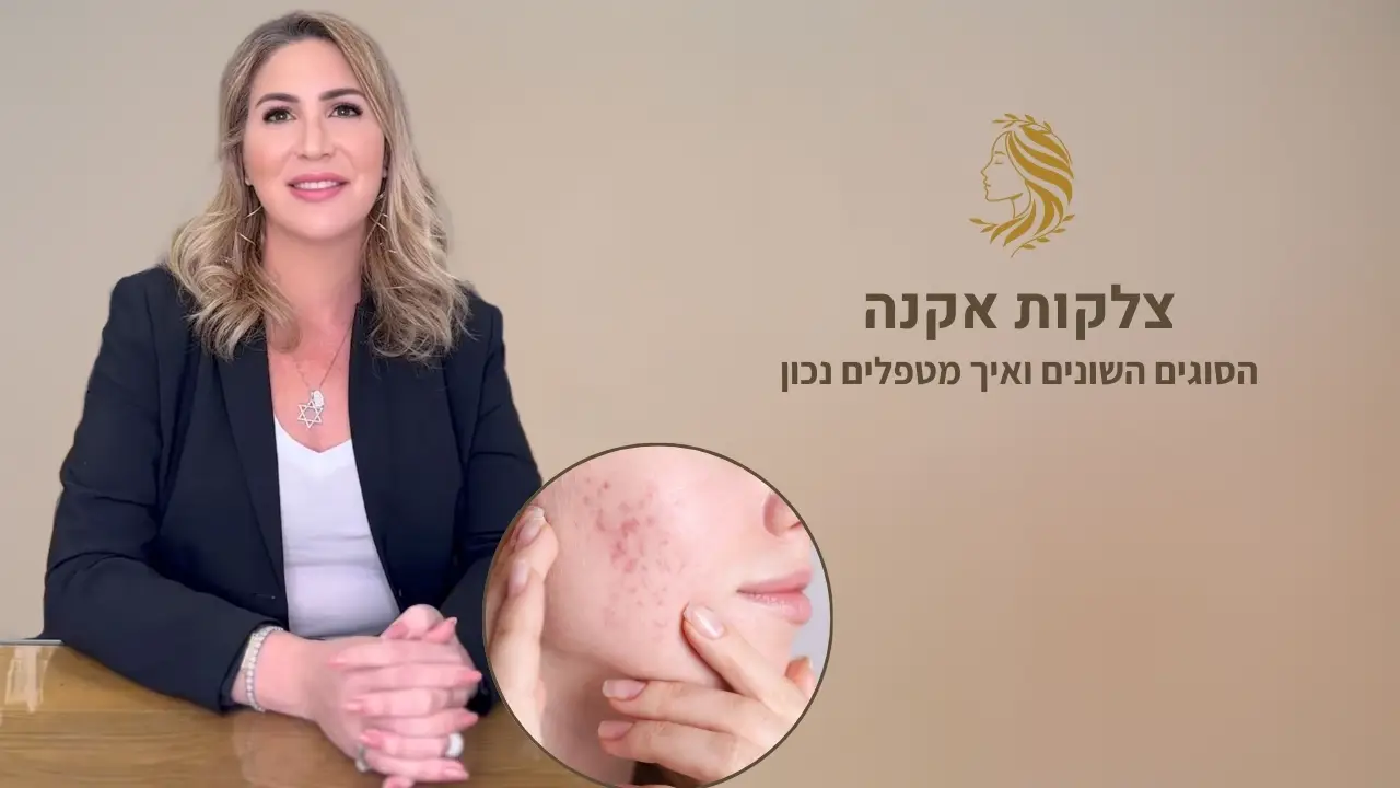 סרטון - לייזר לצלקות אקנה, ד"ר אלה אגוזי דף: פילינג לייזר