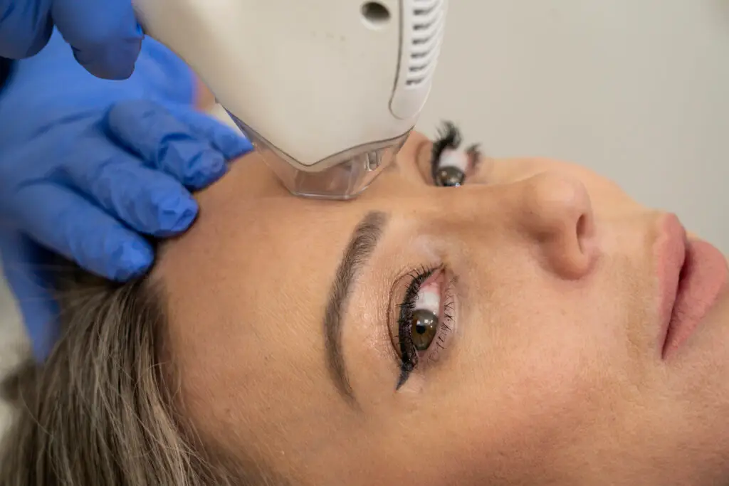 טיפול בפיגמנטציה - המרכז לרפואת עור ואסתטיקה, ד״ר אלה אגוזי