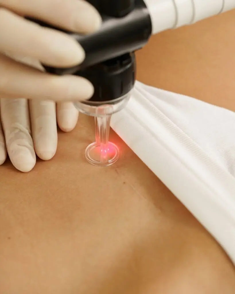 טיפול בצלקות אחרי ניתוח - ד״ר אלה אגוזי