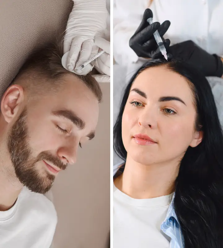 טיפול בנשירת שיער - ד"ר אלה אגוזי