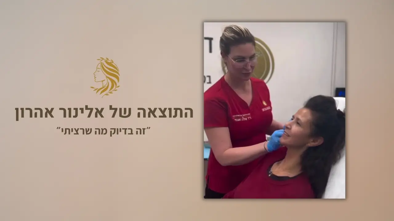 לקוחה ממליצה על טיפולי פיסול פנים - המרכז לרפואת עור וטיפולי אסתטיקה, ד"ר אלה אגוזי