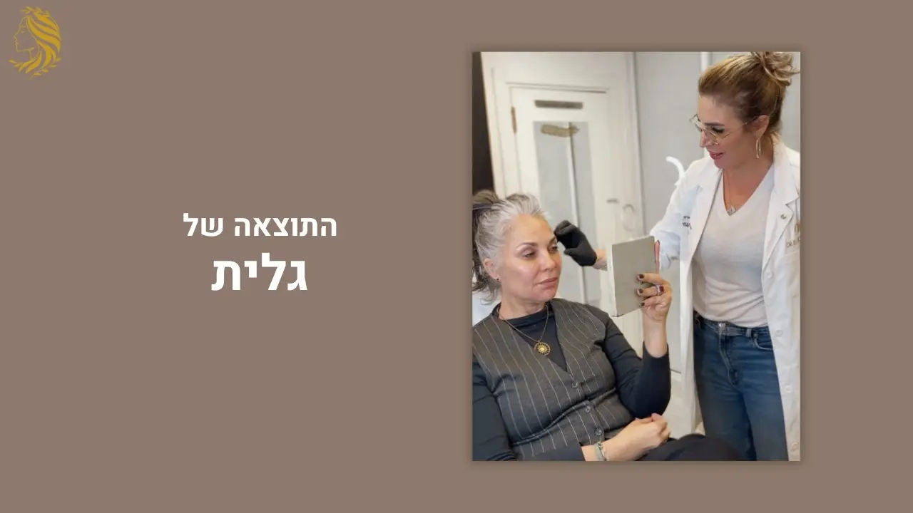 לקוחה ממליצה על טיפולי בוטוקס - המרכז לרפואת עור וטיפולי אסתטיקה, ד"ר אלה אגוזי