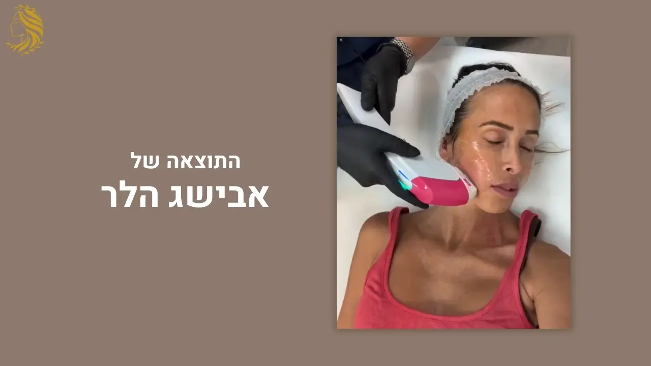 לקוחה ממליצה על טיפול מיצוק עור הפנים - המרכז לרפואת עור וטיפולי אסתטיקה, ד"ר אלה אגוזי
